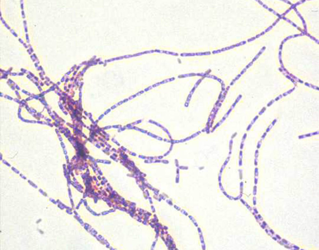 Anthrax Cells